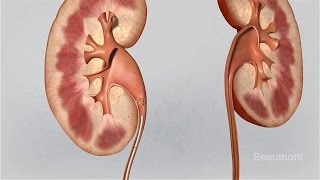 Acute Interstitial Nephritis AIN  Causes Pathophysiology Symptoms Diagnosis Treatment [upl. by Lacie]