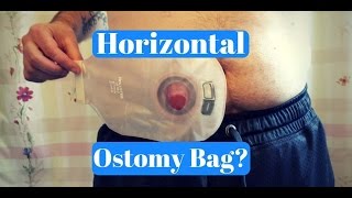 Wearing Your Ostomy Bag Horizontally FAQ [upl. by Yra264]